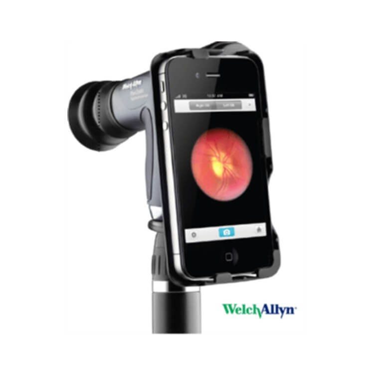 Welch Allyn Welch Allyn iExaminer Accessory - Medscope